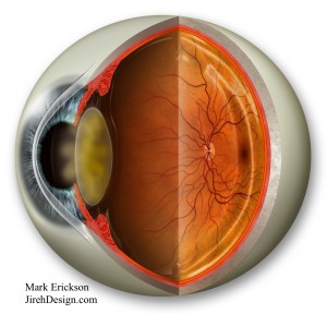 Are cataracts caused by FOV? Randall V. Wong, M.D.
